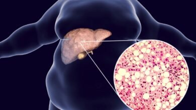 Fatty Liver Symptoms: फैटी लीवर के 5 आम संकेत, जिन्हें नजरअंदाज करना हो सकता है खतरनाक